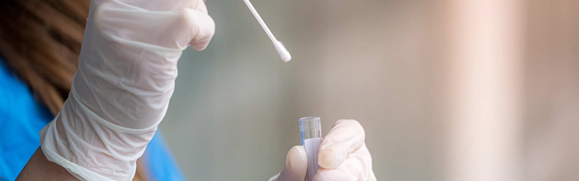 cheek swab sample being prepared in lab