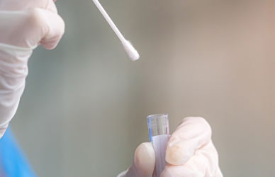 cheek swab sample being prepared in lab